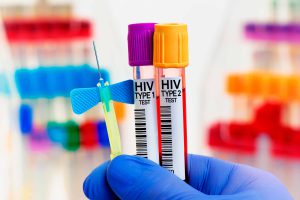 Salud: se confirmo el tercer paciente curado de VIH en el mundo