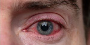 Salud: ¿Cómo proteger los ojos de las pantallas de los celulares y computadoras?