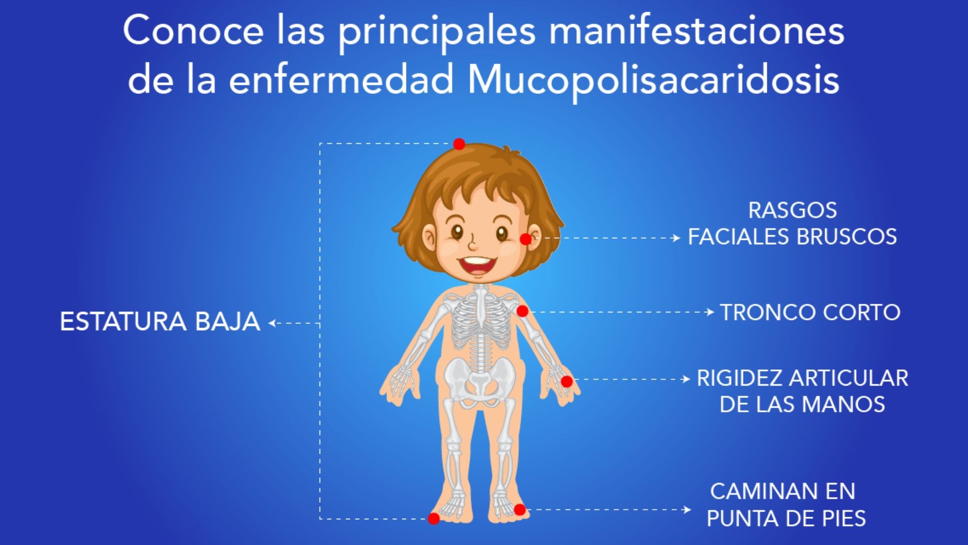 Día Mundial de las Mucopolisacaridosis: Diagnóstico temprano y seguimiento en el tiempo 2 MMX_19.jpg