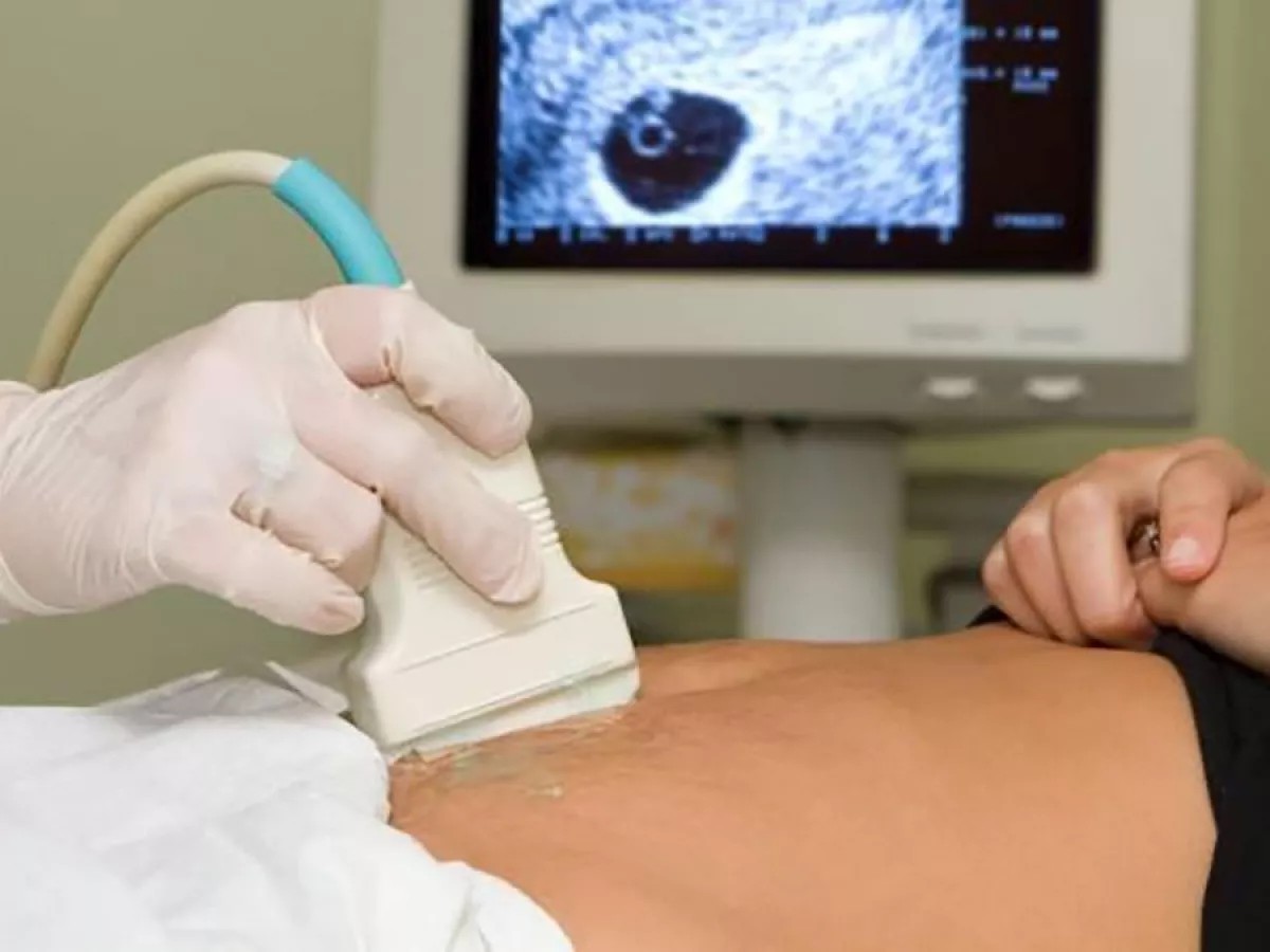 Ley aborto: se relevo las estadísticas a dos años de su sanción 1 aborto.jpg