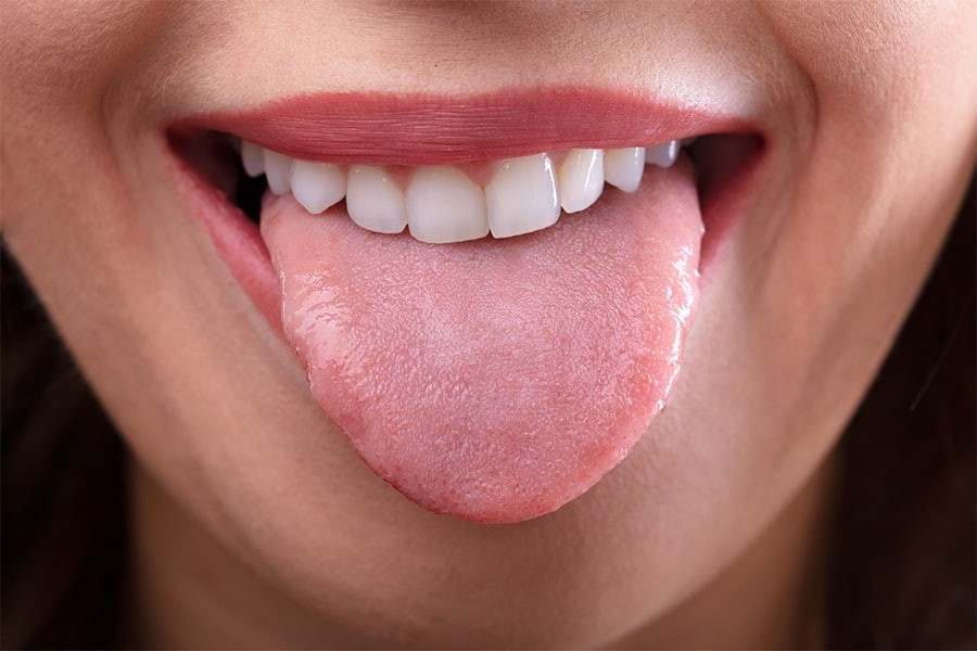 Día Mundial de Sacar la Lengua: ¿Por qué se celebra el 19 de julio? 1 lengua.jpg