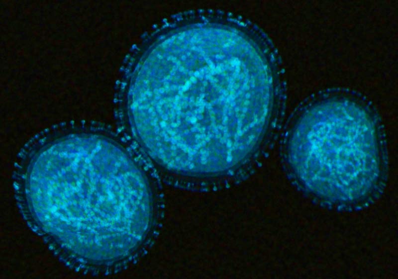 Viruela símica: ya son dos los muertos por el virus en Argentina 1 z.jpg